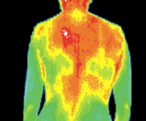 Matsu Skin Deep Thermal Imaging Back Pain Scan 300×248