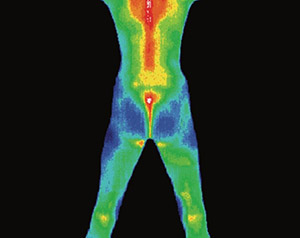 Matsu Skin Deep Thermal Imaging Body Back Scan 300×248