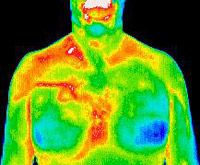 12 Matsu Skin Deep Thermal Imaging Male Breast Cancer Scan 200×165