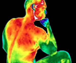 Matsu Skin Deep Thermal Imaging Man Back Scan 300×248
