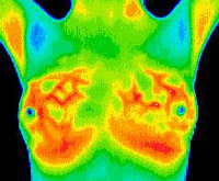 2 Matsu Skin Deep Thermal Imaging Pregnancy Breast Scan 200×165