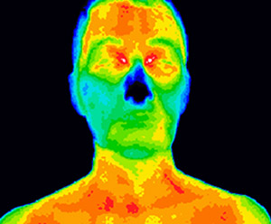 Matsu Skin Deep Thermal Imaging Woman Face Scan 300×248