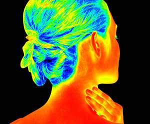 Matsu Skin Deep Thermal Imaging Woman Head Scan 300×248